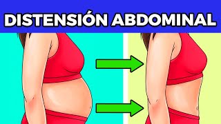 Como reducir la distension abdominal rapidamente [upl. by Ynagoham]