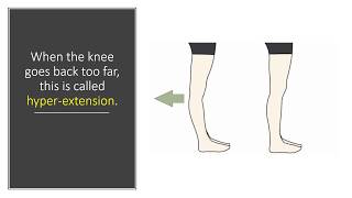 Knee Goes Back Too Far Dr Centeno Explains Knee Hyperextension [upl. by Rodrigo]