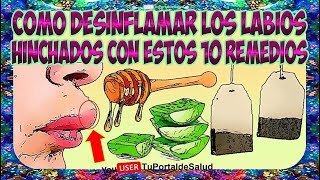 Como Desinflamar Disminuir el Labio Hinchado  10 Remedios Para Desinflamar el Labio Inflamado😚 [upl. by Alyson]