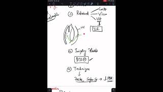 Case 2 Pseudophakic Bullous Keratopathy PBK [upl. by Blumenthal]