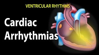 Cardiac Arrhythmias Animation [upl. by Namzed]