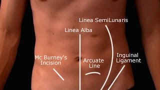 Appendicitis Ultrasound Lecture Version 01 [upl. by Aicela]