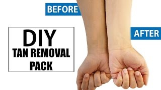 DIY Natural Ways To Get Rid Of Sun Tanned Skin Instantly At Home  DIY Home Remedies [upl. by Llovera]