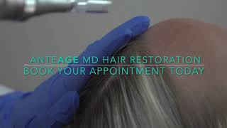 AnteAGE MD Hair Restoration [upl. by Steele779]