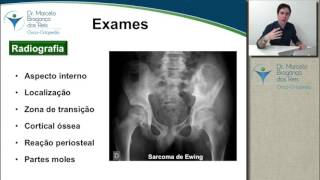 Avaliação por imagem dos tumores ósseos [upl. by Aikemal870]