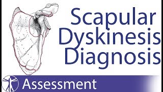 Diagnosing Scapula Dyskinesia [upl. by Bausch]