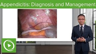 Appendicitis Diagnosis and Management – General Surgery  Lecturio [upl. by Breech377]