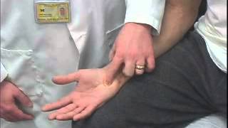 Ulnar Compression Test [upl. by Daveda349]