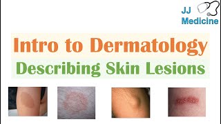 Introduction to Dermatology  The Basics  Describing Skin Lesions Primary amp Secondary Morphology [upl. by Anaibib]