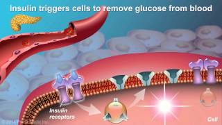 Understanding Type 2 Diabetes [upl. by Llemart414]