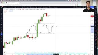 Como Usar Zonas de quotIMBALANCEquot Correctamente  Forex [upl. by Fiorenza]