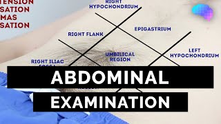 Abdominal Examination  OSCE Guide Latest  UKMLA  CPSA  PLAB 2 [upl. by Alywt]