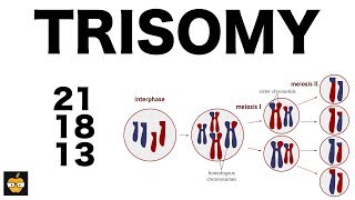 Trisomy 21 18 and 13 amp Nondisjunction Genetics [upl. by Anaahs]