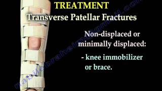 Patellar Fractures  Everything You Need To Know  Dr Nabil Ebraheim [upl. by Maurie973]