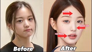 Ive Wonyoung EXTREME plastic surgery [upl. by Angel]