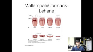 5 minute refresher Difficult Airway Assessment [upl. by Gaul]