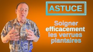 ASTUCE  Extraire EFFICACEMENT une verrue plantaire [upl. by Lerraf]