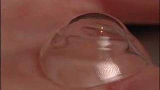 Assessing a scleral contact lens [upl. by Reifnnej187]