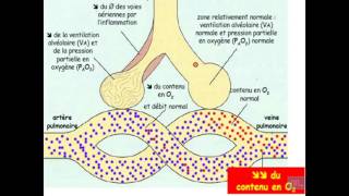 Semiologie de linsuffisance respiratoire Partie 1 [upl. by Hadias]