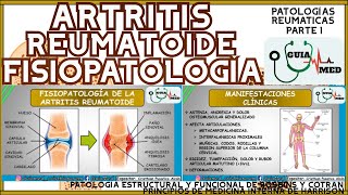 ARTRITIS REUMATOIDE FISIOPATOLOGÍA  GuiaMed [upl. by Nsaj]