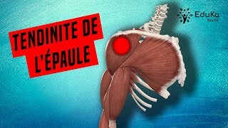 COMPRENDRE LA TENDINITE DE LÉPAULE Explications professionelles [upl. by Yruok]