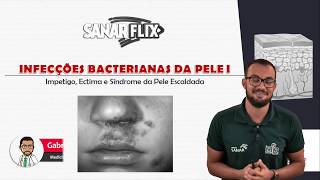 Infecções bacterianas de pele Parte 1  Impetigo ectima e pele escaldada  Aula SanarFlix [upl. by Aciemaj900]