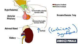 Understanding The Dexamethasone Suppression Test [upl. by Nikolai]