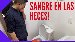 Sangre en las heces  causas de evacuar sangre [upl. by Animsay]