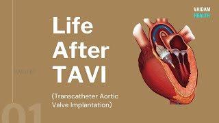 Life After TAVI Transcatheter Aortic Valve Implantation [upl. by Ylrebmik]