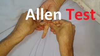 Allen´s Test  Radial vs Ulnar arteries [upl. by Aitnuahs295]