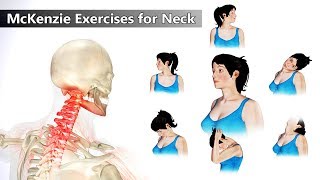 6 Mckenzie Exercises for Neck Pain Relief [upl. by Werdna]