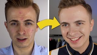 How I Transformed My Face  Best Mens Face Moisturizer [upl. by Gnouh]