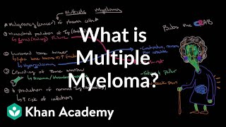 How I Got Diagnosed with Cancer  Beths Multiple Myeloma Patient Story 1 of 5  The Patient Story [upl. by Marika]