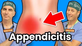 Appendicitis  How Do I Know If I Have Appendicitis [upl. by Dacy740]