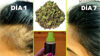 Recupera cabello de LAS SIENES y zonas despobladas con esta receta💪🟢Cabello fortalecido y sin caída [upl. by Laszlo150]