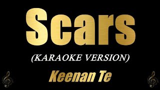 SCARS  Keenan Te Karaoke Version [upl. by Oelc]