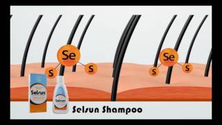 Selsun AntiDandruff Shampoo [upl. by Gough]