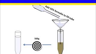 Fecal Flotation Concentration Zinc Sulfate Method [upl. by Karee48]