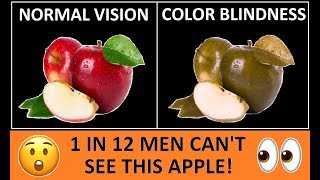 Types of Color Blindness  Color Vision Deficiency [upl. by Imrots]