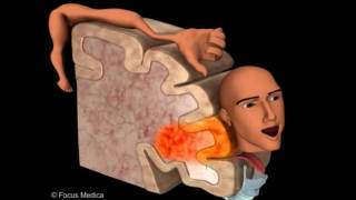 Primary Motor Cortex  Neuroanatomy [upl. by Aissatsan]