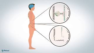 Douleurs neuropathiques et dysfonctionnelles explication [upl. by Jentoft]