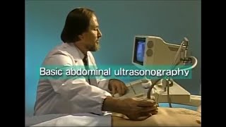 How to do abdominal ultrasound examination [upl. by Flanagan755]