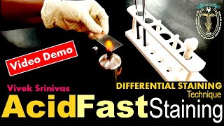 ACID FAST STAINING  Bacterial Staining Technique  Microbiology  Vivek Srinivas  Mycobacterium [upl. by Yleme]