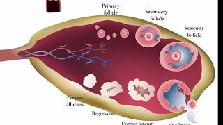 Ovarian Cysts [upl. by Skerl]