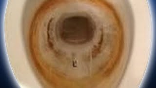 How To Get Rid of Toilet Stains Pt 2  How to Use Muriatic Acid to Clean Toilet Bowl HD [upl. by Hacceber796]