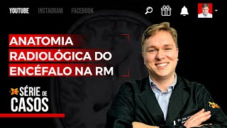 Anatomia Radiológica do Encéfalo na RM [upl. by Sachsse880]